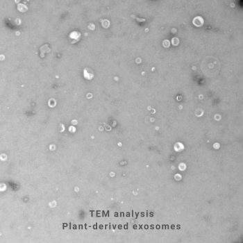 Plant-derived exosomes